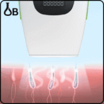 Professional IPL Laser Hair Removal Device - Image 7