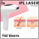 Professional IPL Laser Hair Removal Device - Image 6