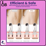 Ultra IPL Laser Hair Removal Device - Image 3